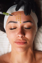 BioRe Peel CL3 Masterclass (Board Certified)