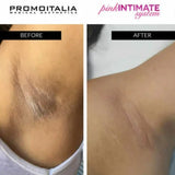 Intimate Lightening Certificate Course (Board Certified)