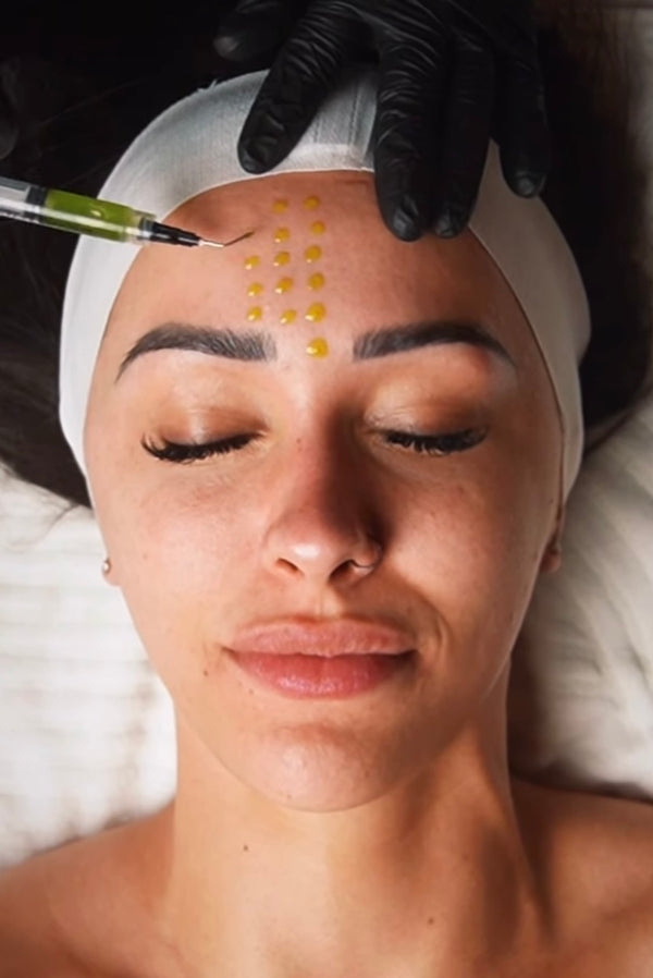 BioRe Peel CL3 Masterclass (Board Certified)