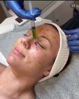 BioRe Peel CL3 Masterclass (Board Certified)