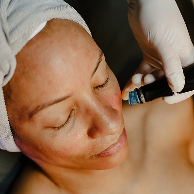 HydraFacial Training Course