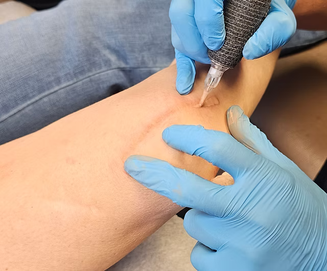 Paramedical Tattoo Scar Camouflage Training