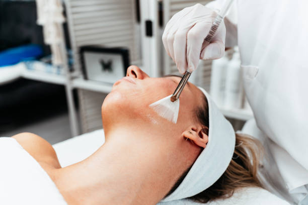 The Perfect Derma Peel Training Course