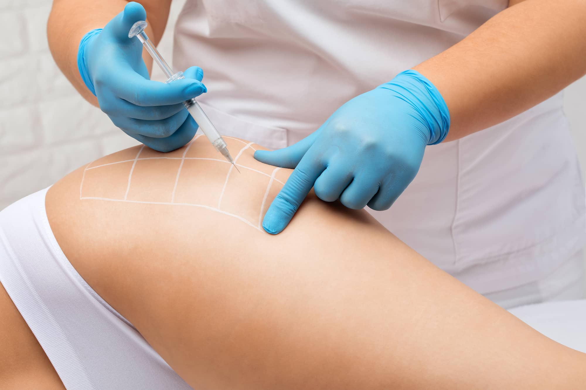 Fat Loss Injections Training Course