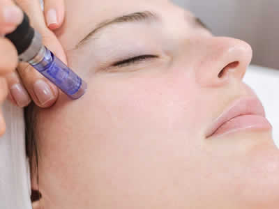 Microneedling for Face and Scalp Training