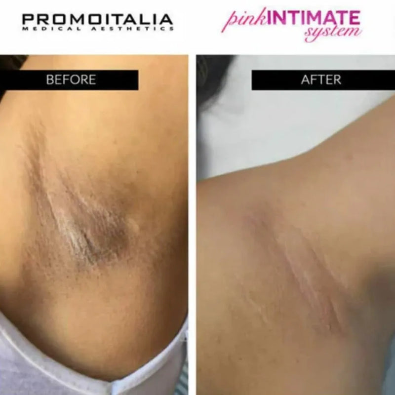 Intimate Lightening Certificate Course (Board Certified)