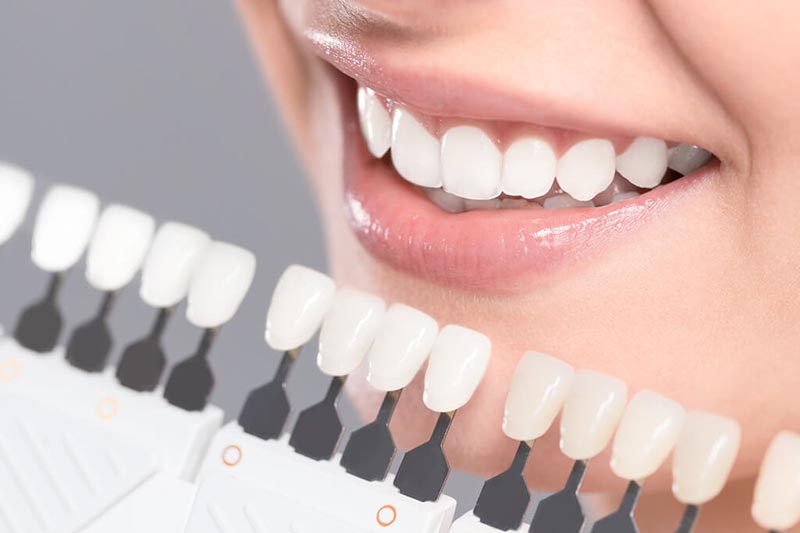 Teeth Whitening Training Course