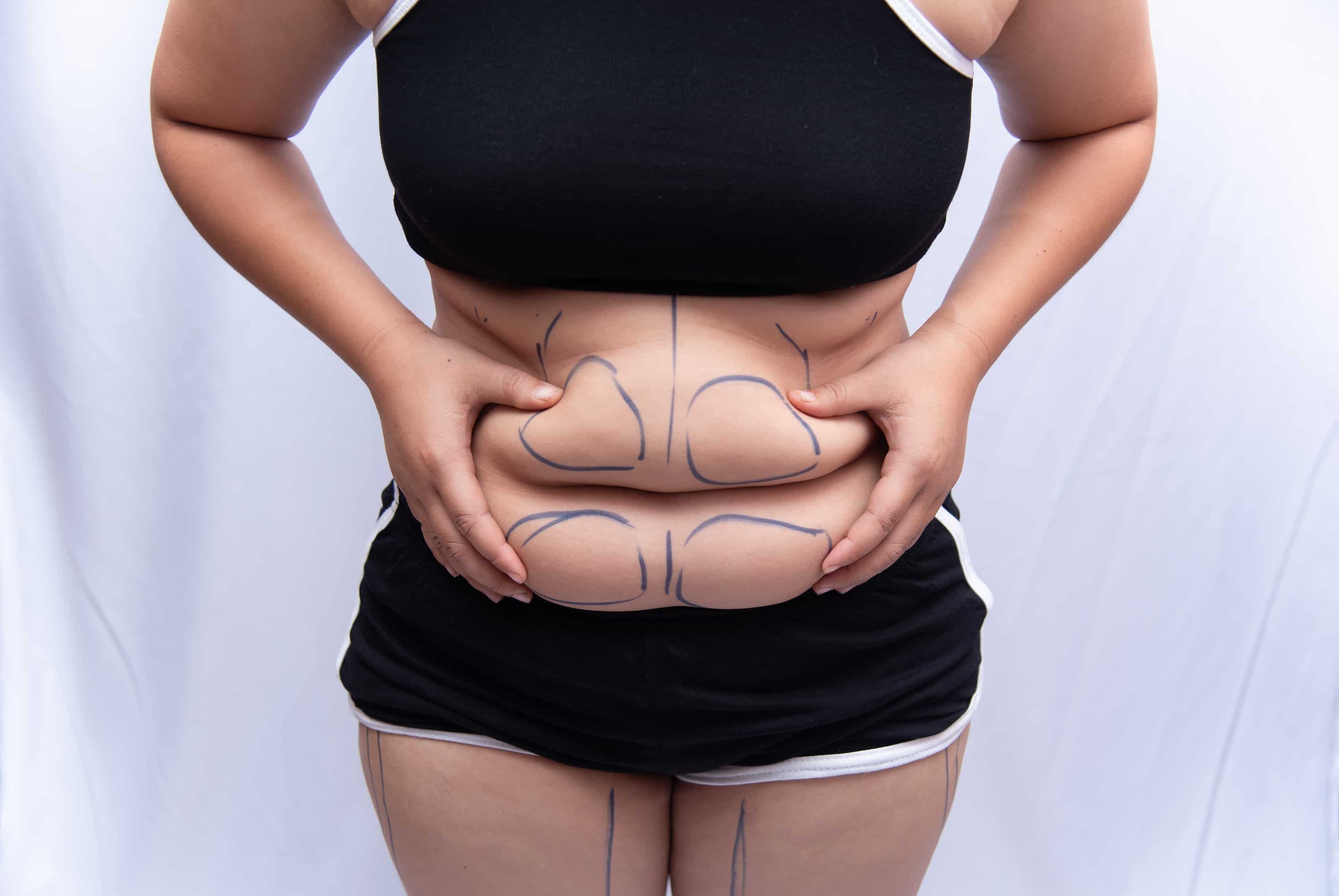 Fat Loss Injections Training Course